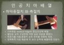 세미나자료 구강해부학의 총의치(덴쳐) 제작(치의학, 치기공, 치위생) 55페이지