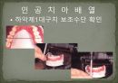 세미나자료 구강해부학의 총의치(덴쳐) 제작(치의학, 치기공, 치위생) 62페이지